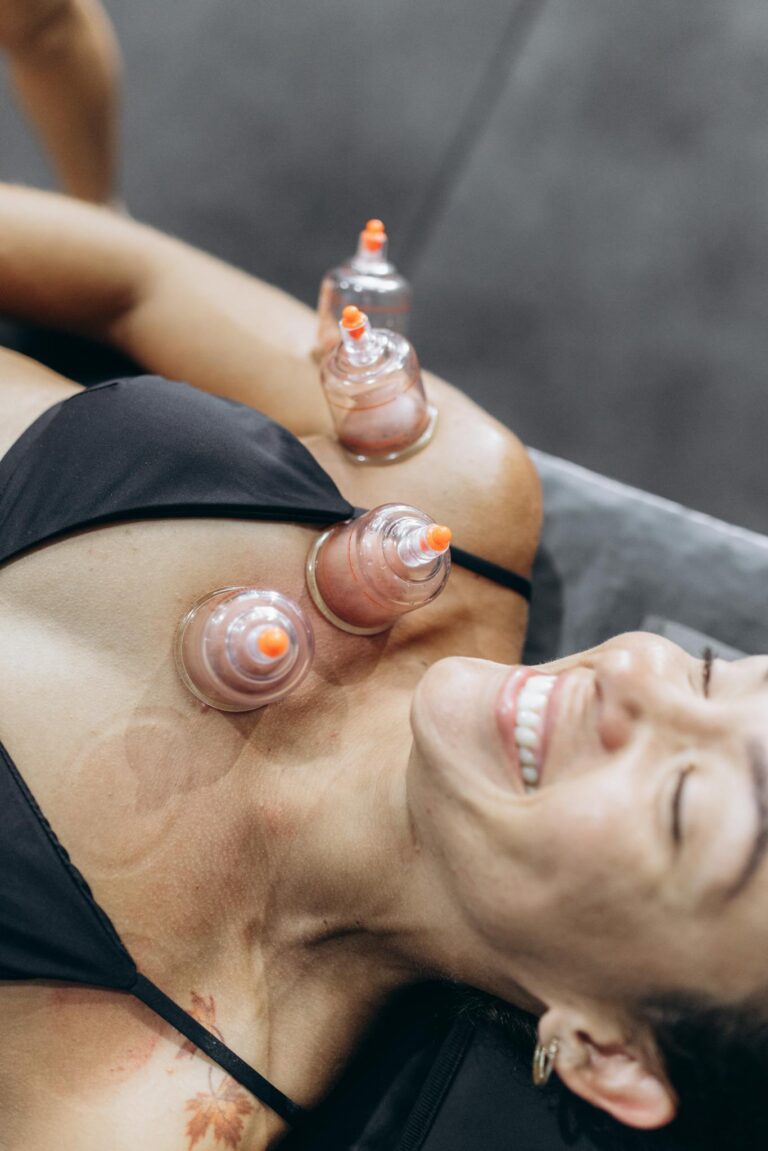 A woman enjoying a relaxing cupping therapy session for health and wellness.